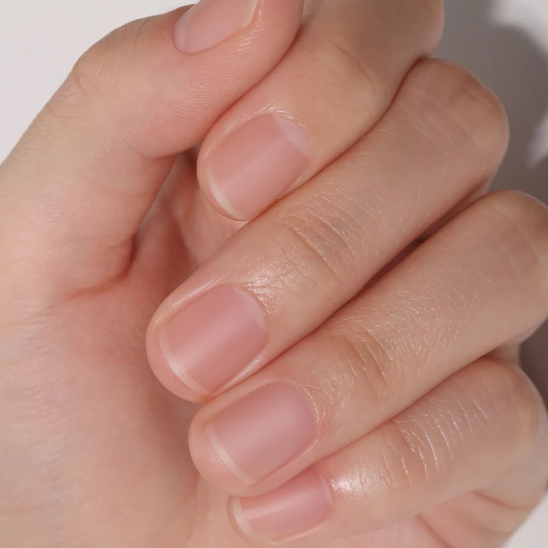 BLUESKY Anti-Nagelbeiß Lack 10ml