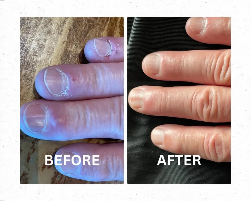 WellNail cuticle and nail balm