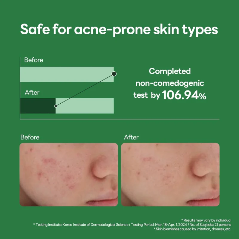 Mediheal Teatree Calming Hydra, Refreshing, Lightweight Hydrating Serum - 40ml