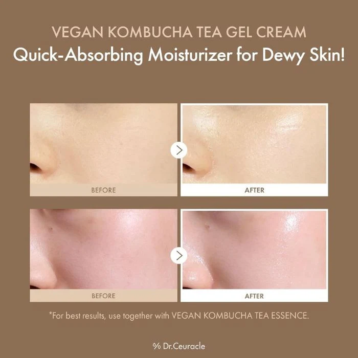 Dr. Ceuracle Vegan Kombucha Tea Gel Cream Probiotic Hydrating Detox Moisturizer 75g