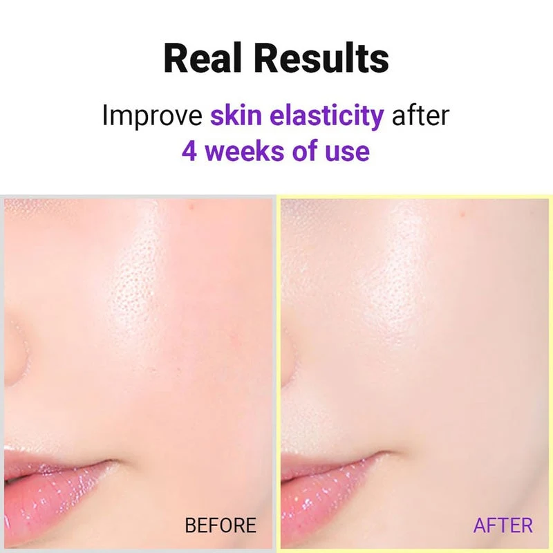Isntree Hyper Retinol Ex 1.0 Face Serum 20ml